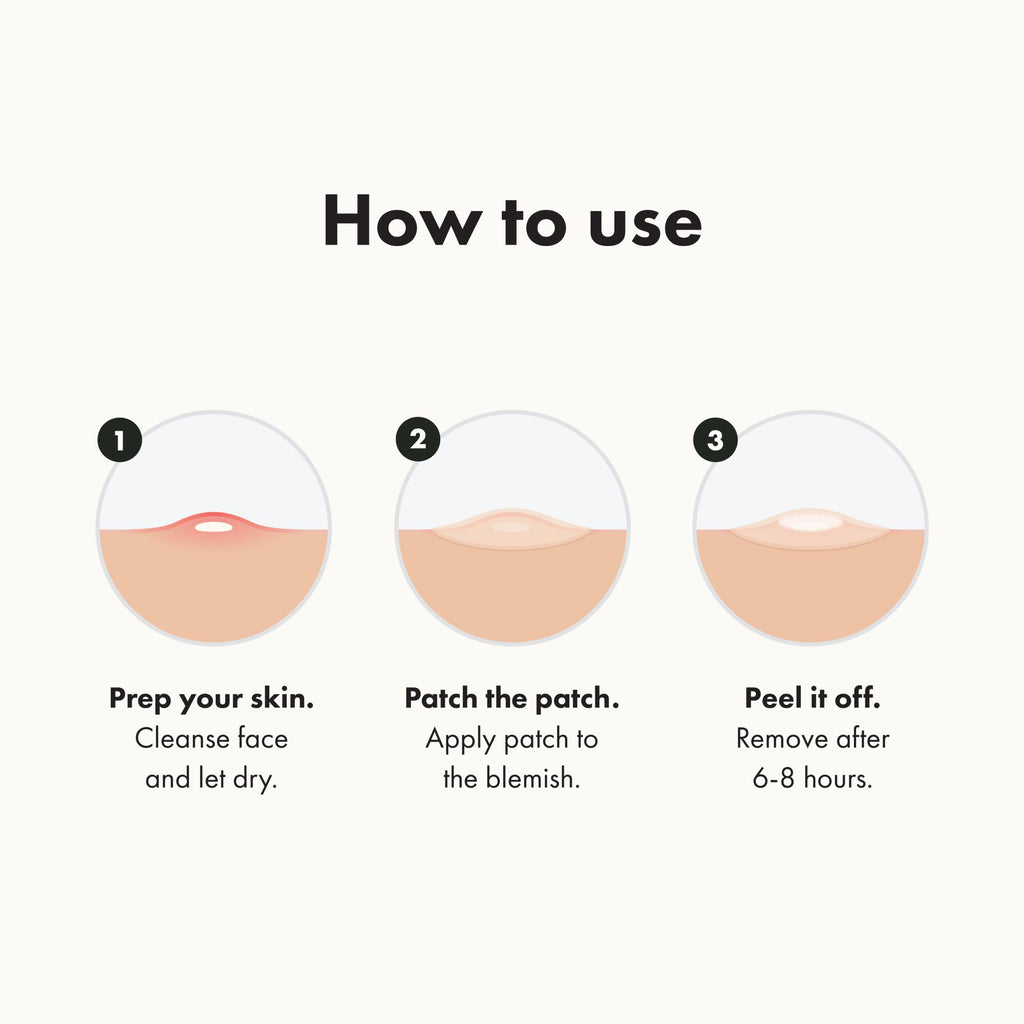 Mighty Patch Original Patch from Hero Cosmetics - #1 Hydrocolloid Acne Pimple Patches for Face, Shrinking Zits & Whiteheads in 1 Use, Nighttime Spot Pimple Stickers for Face, 36 Count