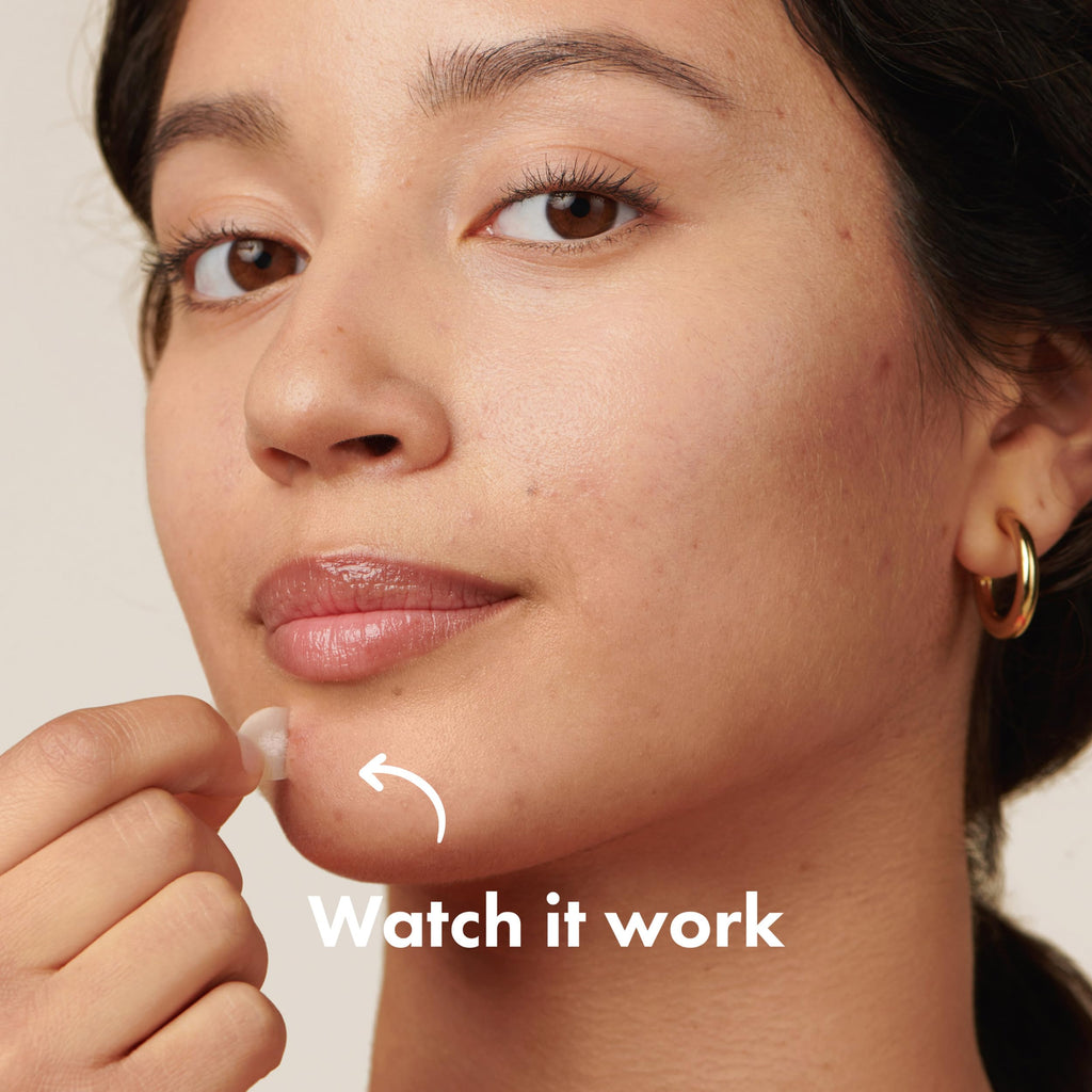 Mighty Patch Original Patch from Hero Cosmetics - #1 Hydrocolloid Acne Pimple Patches for Face, Shrinking Zits & Whiteheads in 1 Use, Nighttime Spot Pimple Stickers for Face, 36 Count